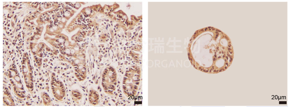 人小肠类器官免疫组织化学染色