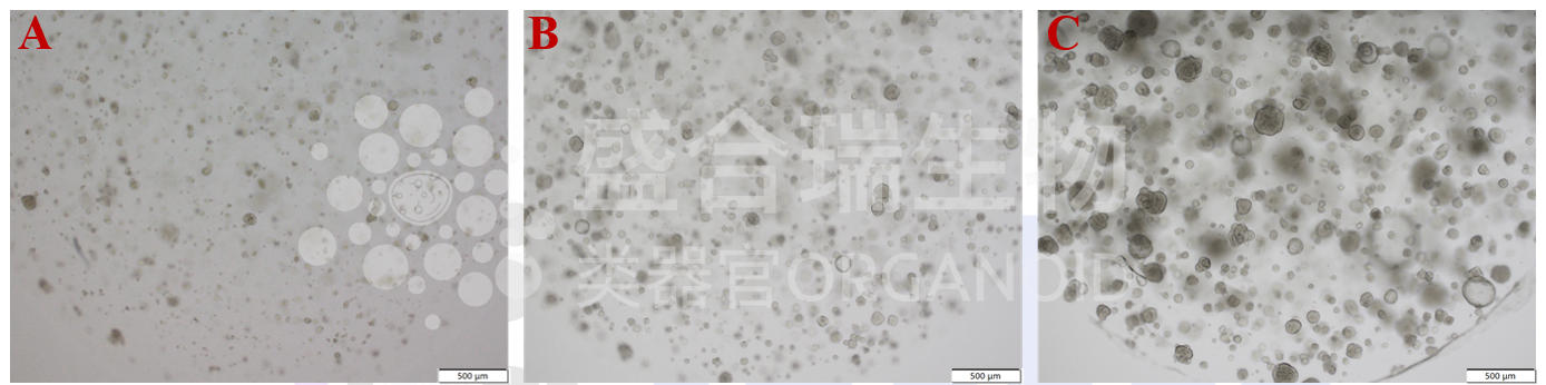 人肾小管类器官传代培养过程示例