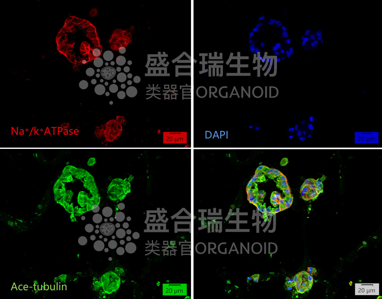 人肾小管类器官免疫荧光染色图