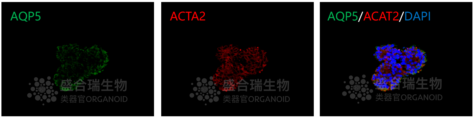 小鼠唾液腺类器官免疫荧光染色图